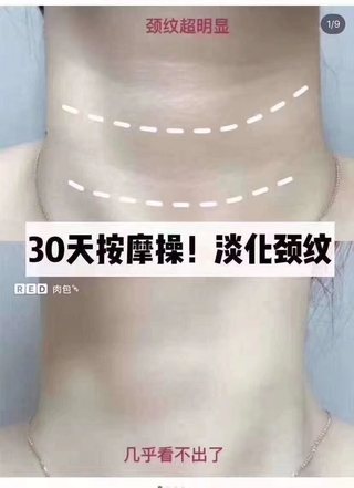 StriVectin斯佳唯婷高效颈霜30ml*2